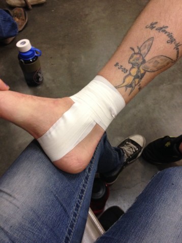 Taping up a sprained ankle